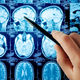 Illustration for article titled 24-Year-Old Woman Actually Missing a Large Part of Her Brain